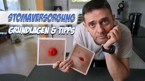 Stomaversorgung Grundlagen Und Tipps Pflege Pflege Kanal Youtube