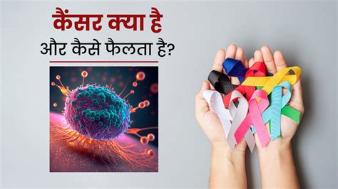 World Cancer Day 2023 कैंसर क्या है और कैसे फैलता है डॉक्टर से जानें