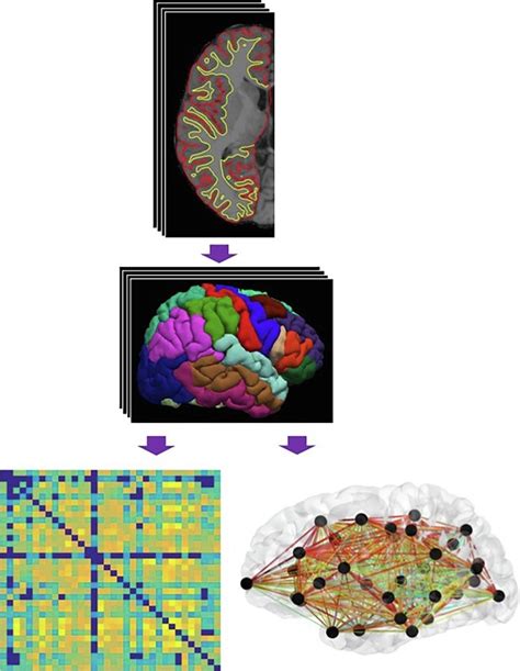 Efficient Organisation Of The Contralateral Hemisphere Connectome Is