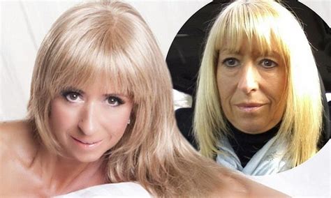 I Had A Naked Photoshoot To Celebrate My New Face Year Old Bares All After Surgery