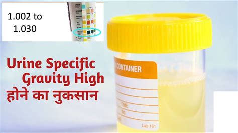 Urine Specific Gravity Urine Specific Gravity Test Youtube