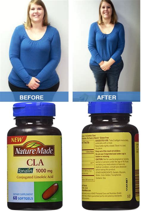 Cla Weight Loss Before And After Weightlosslook