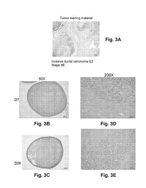 Three Dimensional Bioprinted Tumor Models For Drug Testing Eureka