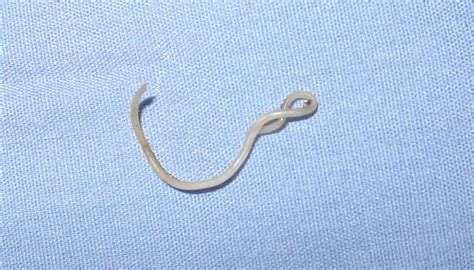 How Do Roundworms Reproduce? | Sciencing