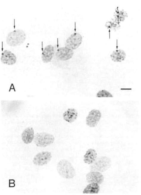 Figure 2 From The Mus Musculus Domesticus Tdy Allele Acts Later Than The Mus Musculus Musculus