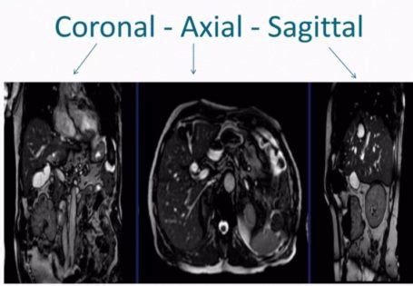 Mri Abdomen Price Purpose Preparation Results