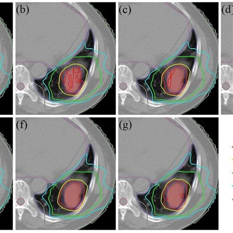 static dose distribution dsd    dynamical dose
