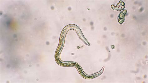 Toxocariasis Causes Symptoms Diagnosis Treatment And Prognosis