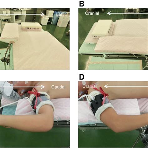 Patient Positioning And Preparation Right Elbow A A Slightly