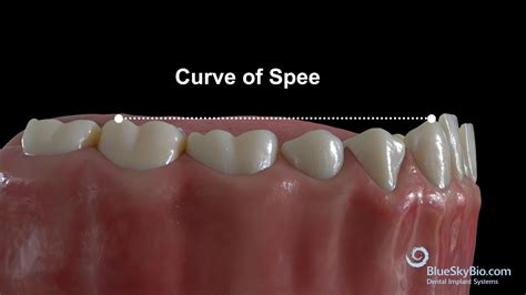 Curve Of Spee And Its Relationship With Dentoskeletal, 59% OFF