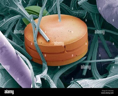 Planktonic Diatom Alga Coloured Scanning Electron Micrograph Sem Of