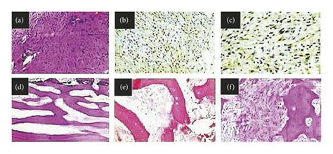 A Representative Photomicrograph For Histological Evaluation With