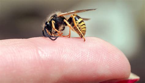 How Dangerous Are Wasp Stings The Wasp Experts Scotland