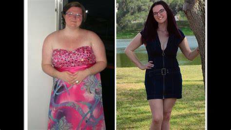 Unzipped With Ashlyn Douglass Barnes A Bariatric Weight Loss Podcast