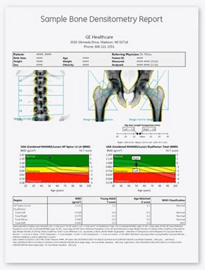 Dxa Scan Results