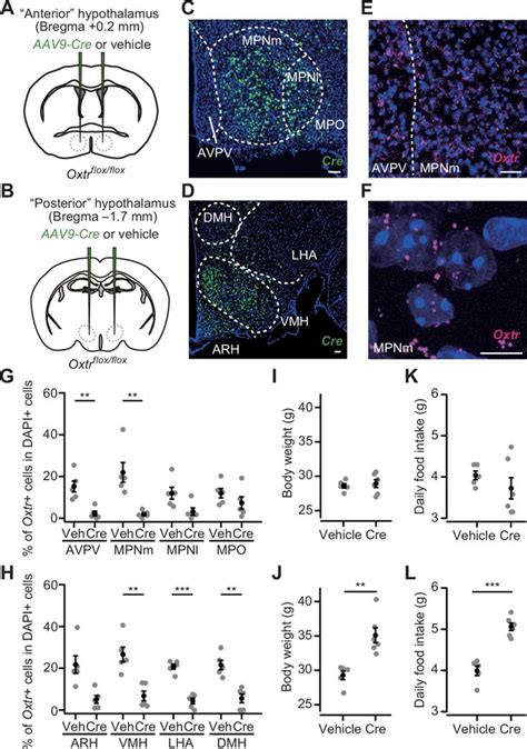 Oxytocin Signaling In The Posterior Hypothalamus Prevents Hyperphagic