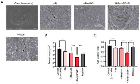 SENP1 Attenuates Hypoxiareoxygenation Injury In Liver Sinusoid