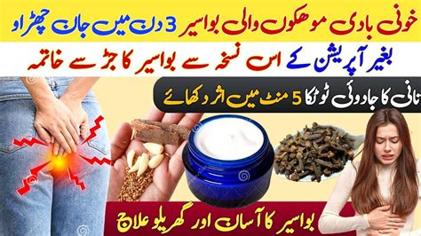 Bawaseer Hemorrhoids Cure Moko Wali Bawaseer Ka Ilaj Bavasir Ki Desi