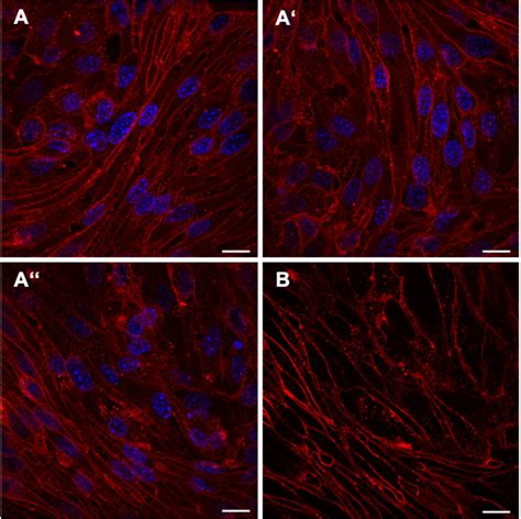 AoEnd Cells After 48 Hours Of Starvation Representative Confocal