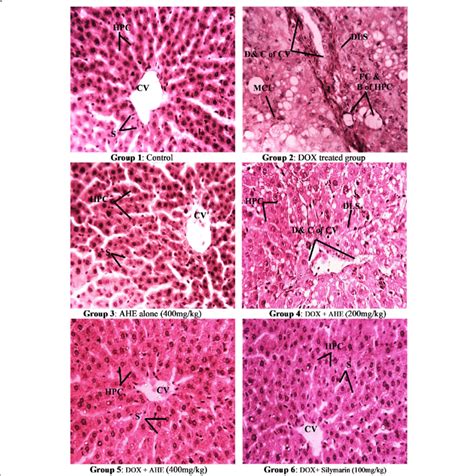 Histopathological Examination Of Rat Liver Hande Staining Magnification