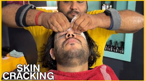 Intense Hair Cracking Head Massage Skin Cracking By Shamboo💈 Asmr