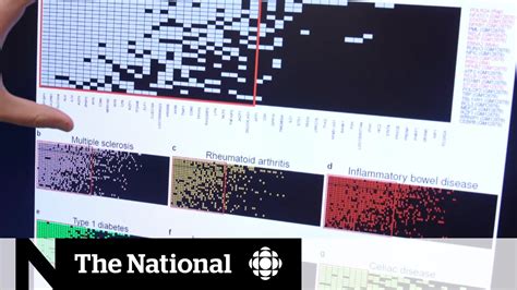 Epstein Barr Virus May Trigger Ms Later In Life Research Suggests Youtube