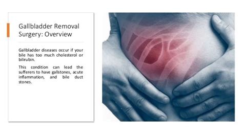 Long Term Side Effects Of Gallbladder Removal You Need To Know Ppt