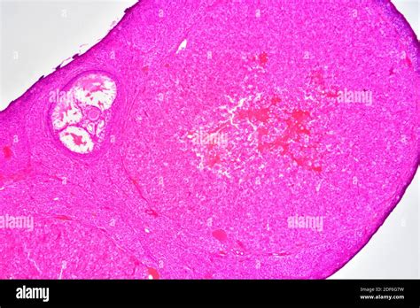 Ovary Section Showing Corpus Luteum Stroma Epithelium And Follicles