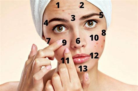 Acne te contamos por que você tem espinhas nestas partes do corpo