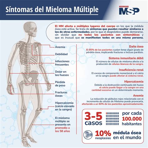 Síntomas del Mieloma Múltiple Infografía