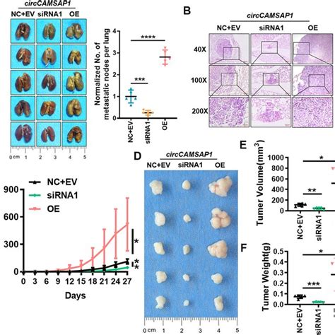 CircCAMSAP1 Promotes Proliferation And Metastasis Of NPC Cells In