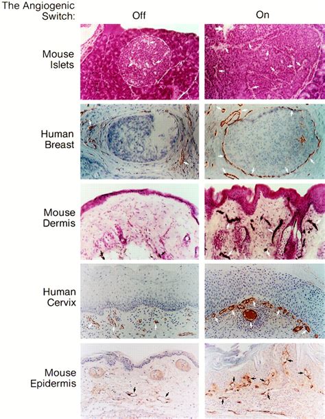 Patterns And Emerging Mechanisms Of The Angiogenic Switch During