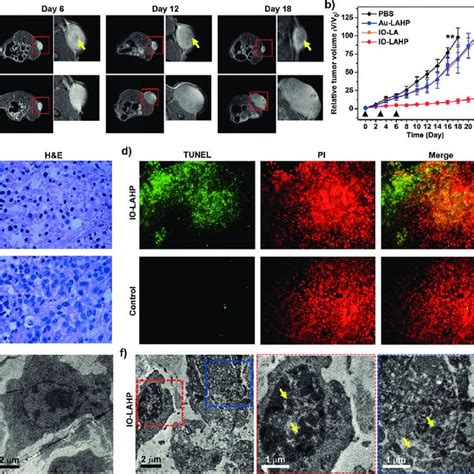 A Cell Viability Study In U Mg Cell Model After Incubation With Pbs