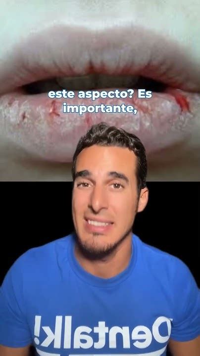 Cómo Curar Los Labios Rotos Secos Quemados O Agrietados Remedios Caseros Youtube