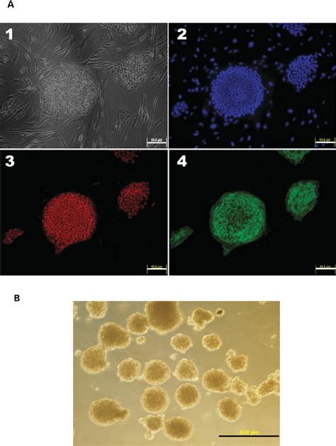 Hes Cell Lines Containing A De Novo Line Retrotransposition Event