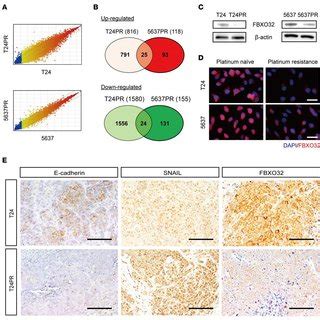 FBXO32 Expression And Survival Outcome Of Surgically Treated Upper