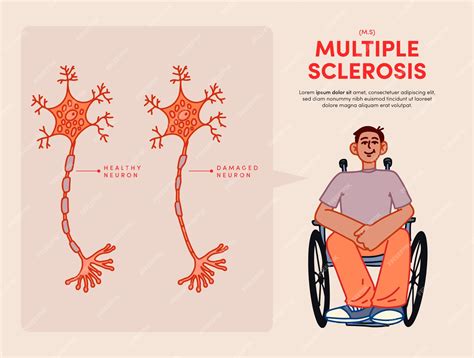 Premium Vector Hand Drawn Multiple Sclerosis Illustration