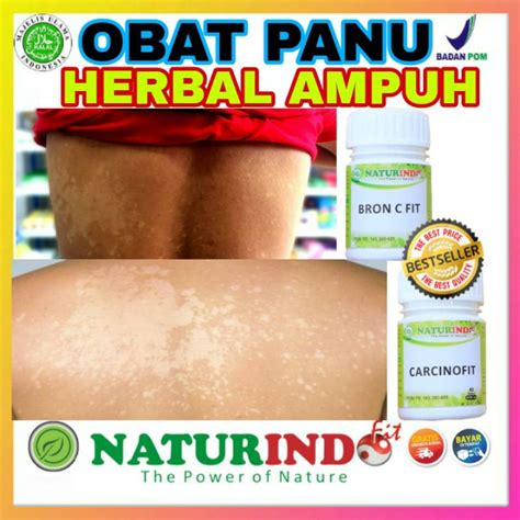 Jual Obat Panu Kadas Kudis Kurap Kutu Air Herpes Exsim Kering Basah