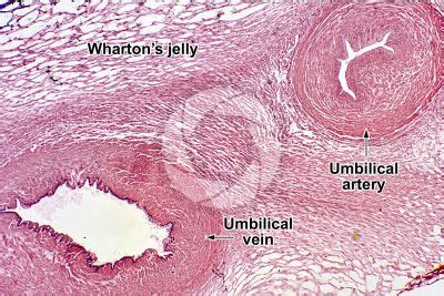 Mucous connective tissue - Connective tissue - Animal tissues - Animal ...