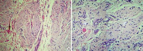 Microphotograph Showing Mature Neural Tissue A With A High Power