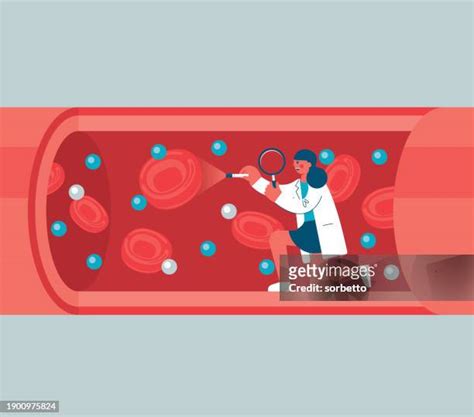 152 Blocked Arteries High Res Illustrations Getty Images