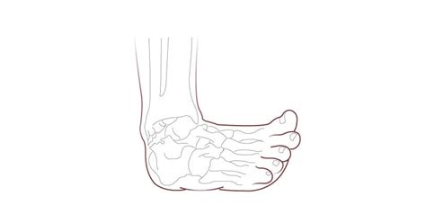 Ankle Injuries Causes Treatments London Foot And Ankle Surgery