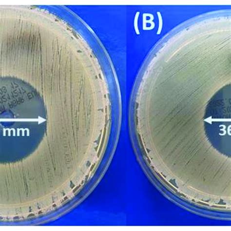 Inhibition Zones Of Staphylococcus Aureus Atcc 25923 After Culture Download Scientific