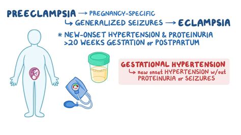 Preeclampsia Eclampsia Nursing Osmosis Video Library