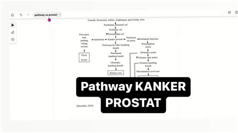 Pathway Kanker Prostat Diagnosa Keperawatan Eps Youtube