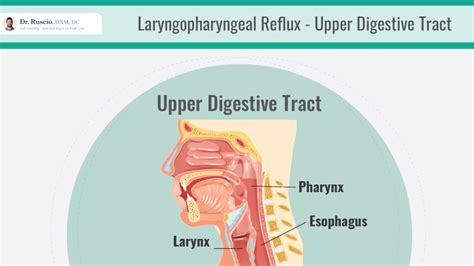 How To Relieve Laryngopharyngeal Reflux Lpr Symptoms