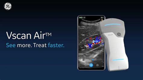 GE Vscan Air Wireless Handheld Ultrasound Cardomedical