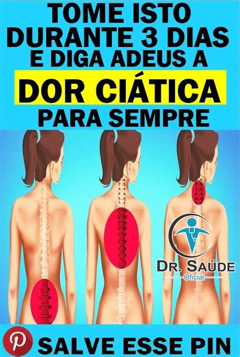 Como Eliminar a Dor no Nervo Ciático em 5 Minutos Health tips