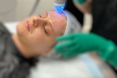 Fractional Radiofrequency Aesthetics And Skin Institute Usac