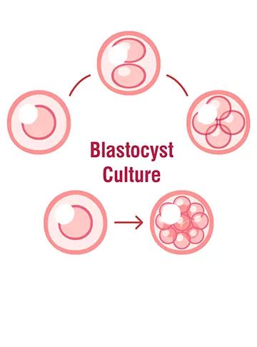 Frozen Blastocyst Transfer & Embryo Implantation | Indira IVF